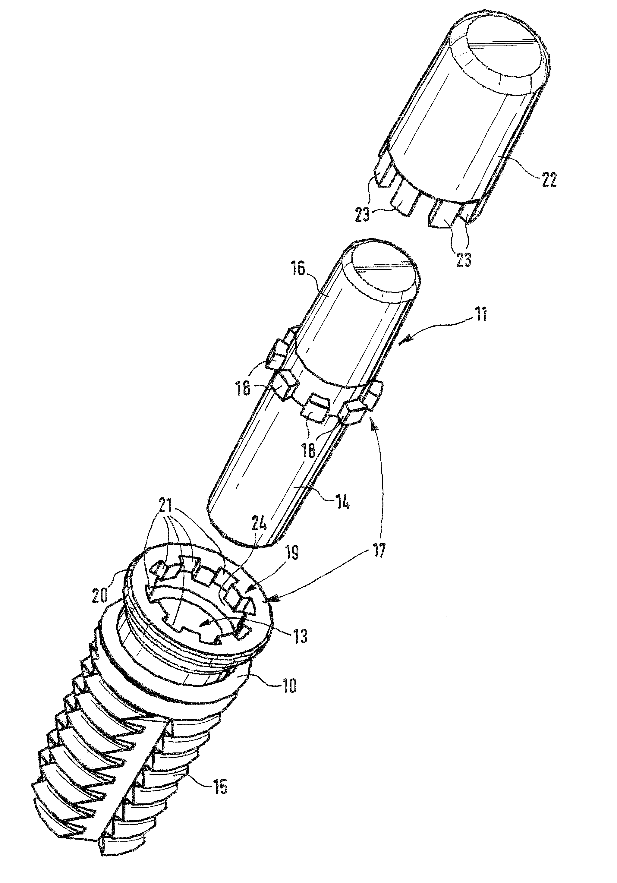 Dental implant, in particular of ceramic material