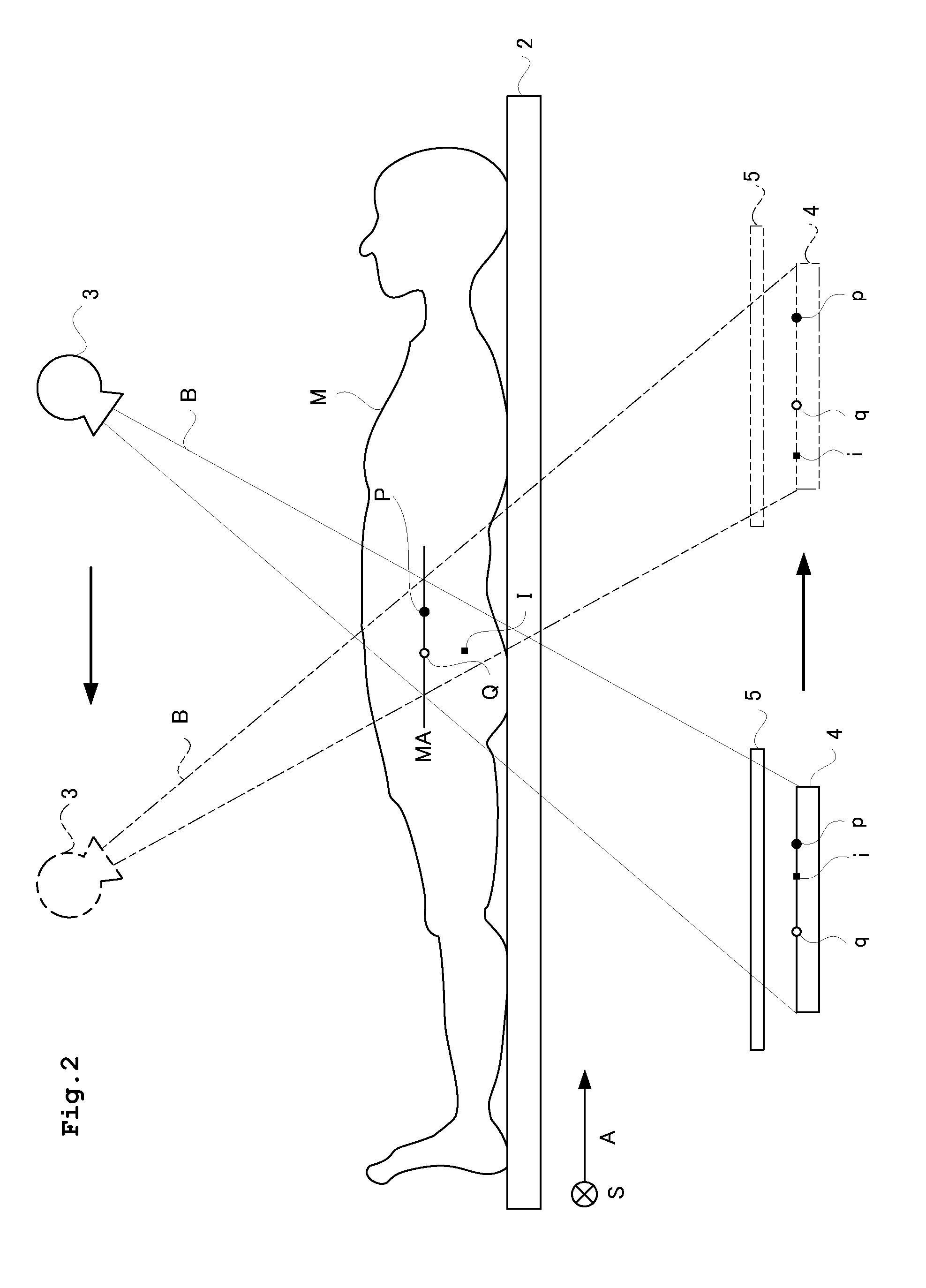 Radiation tomography apparatus