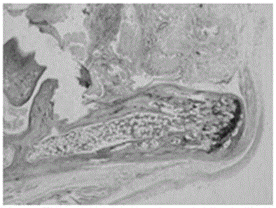 Traditional Chinese medicine preparation for treating acute gouty arthritis and preparation method thereof