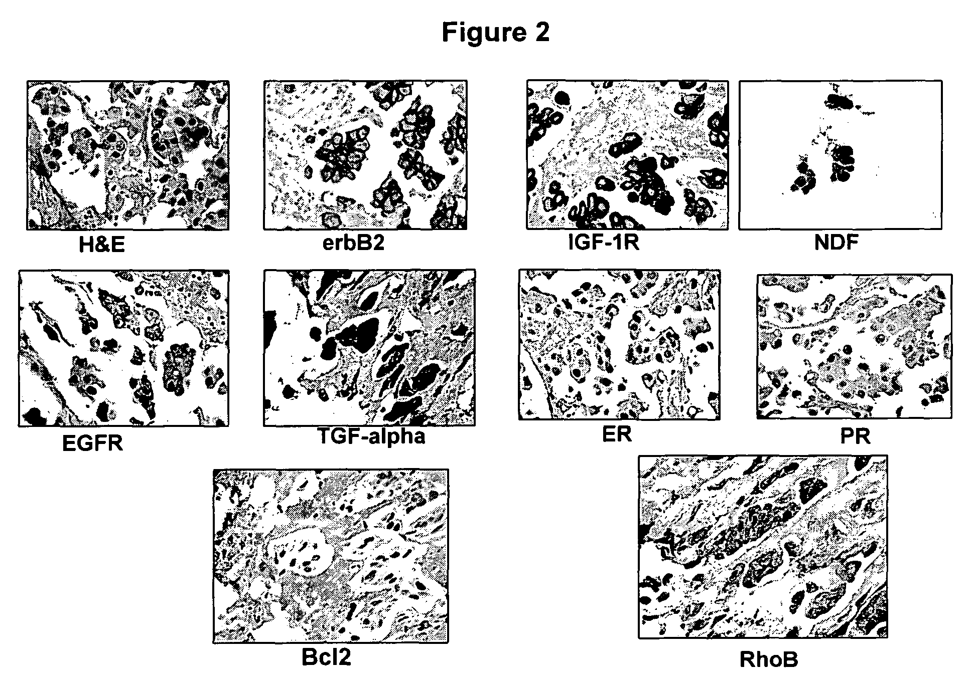 Methods and materials for predicting responsiveness to treatment with dual tyrosine kinase inhibitor