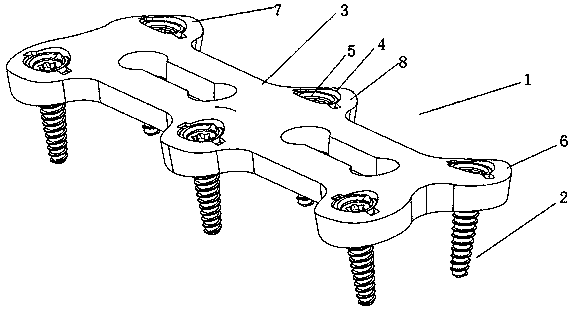 A spinal fixation device