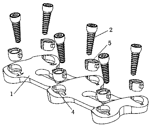 A spinal fixation device