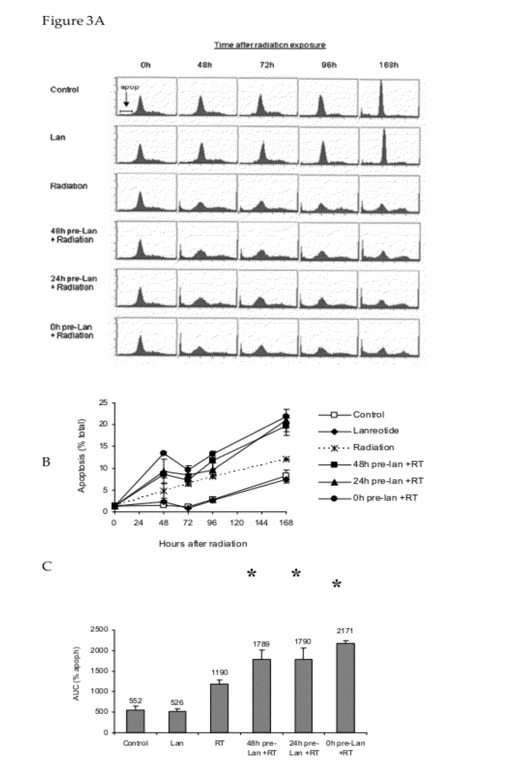 Use of somatostatin or an analogue thereof in combination with external radiation therapy