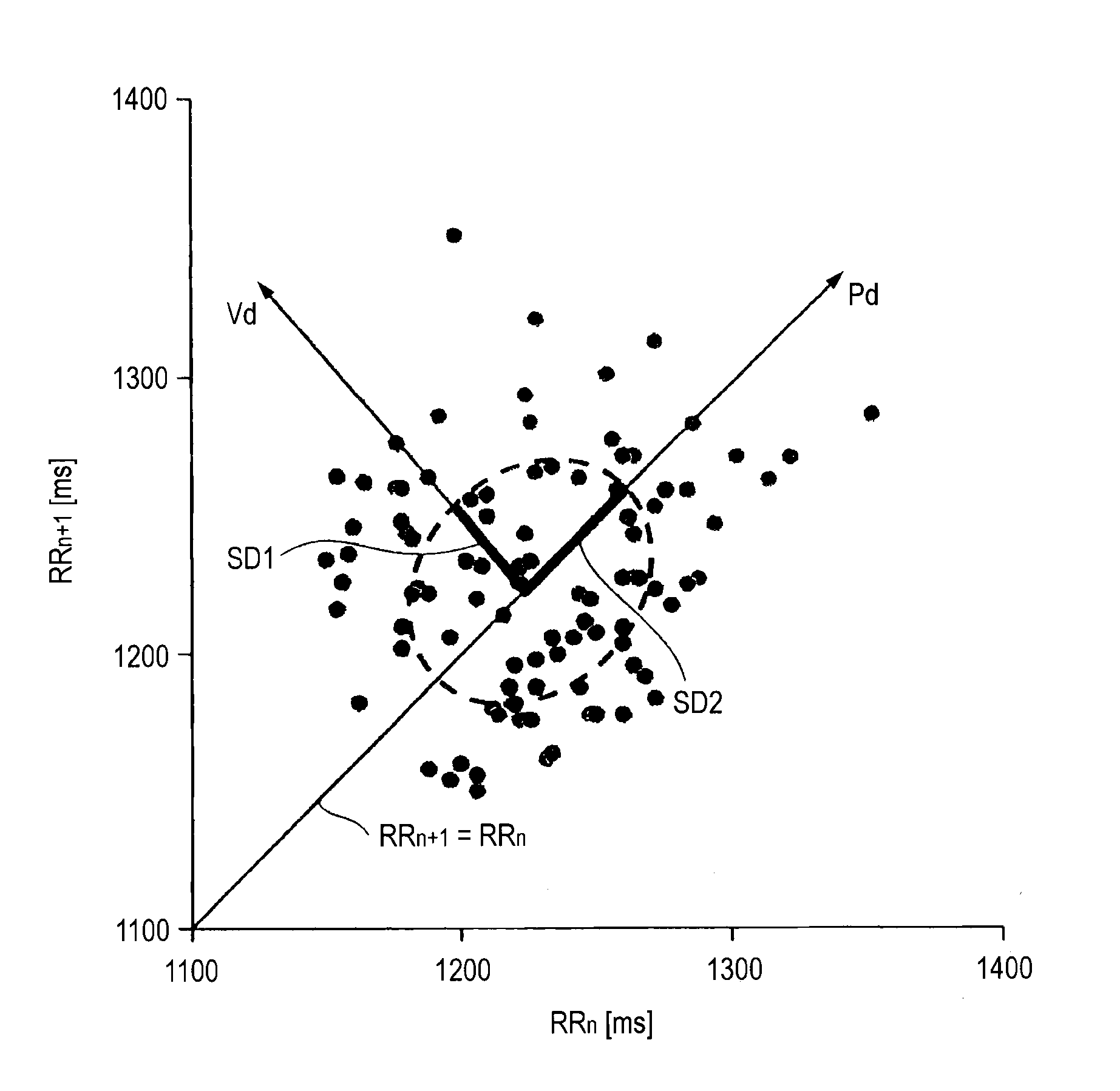 Apparatus and method for detecting epilepsy seizure