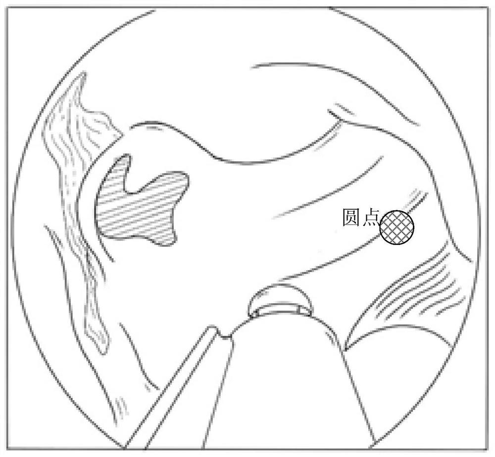 Orbital endoscope navigation operation training method and system, device and equipment