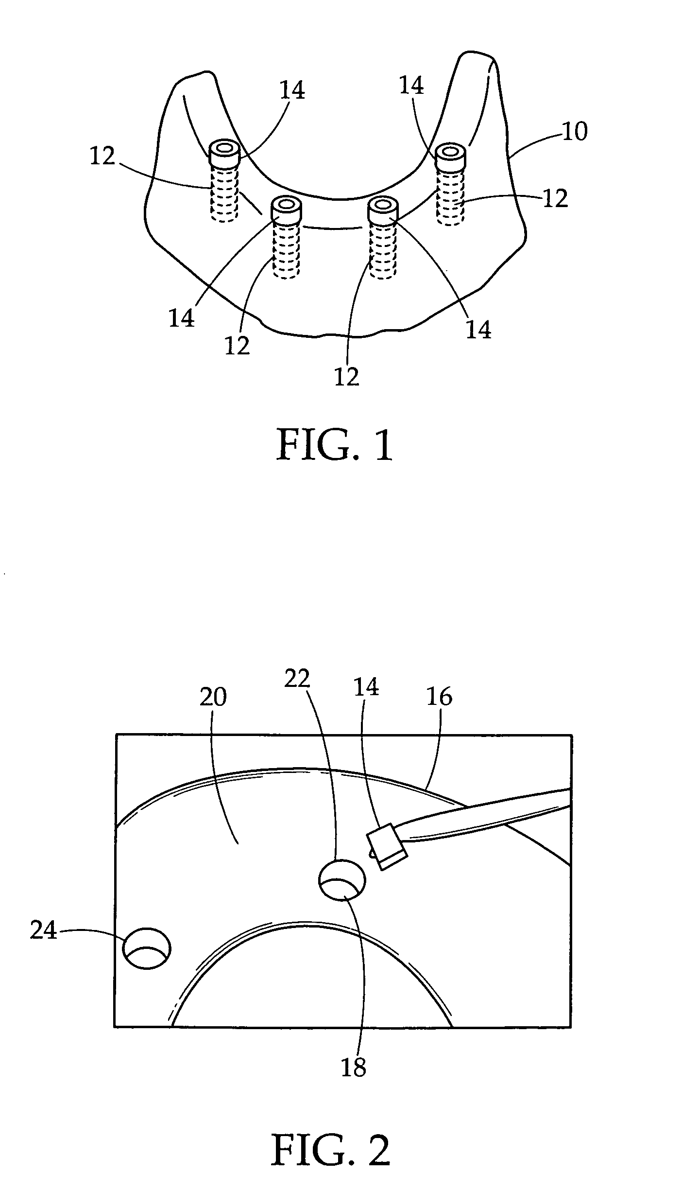 Dental tool for the fitting, installation and replacement of a dental prosthetic attachment