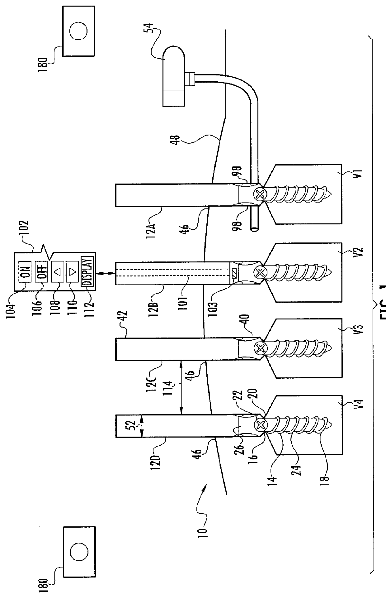 System for Pushing and Pulling Surgical Implants into Position in Vivo Via a Tether