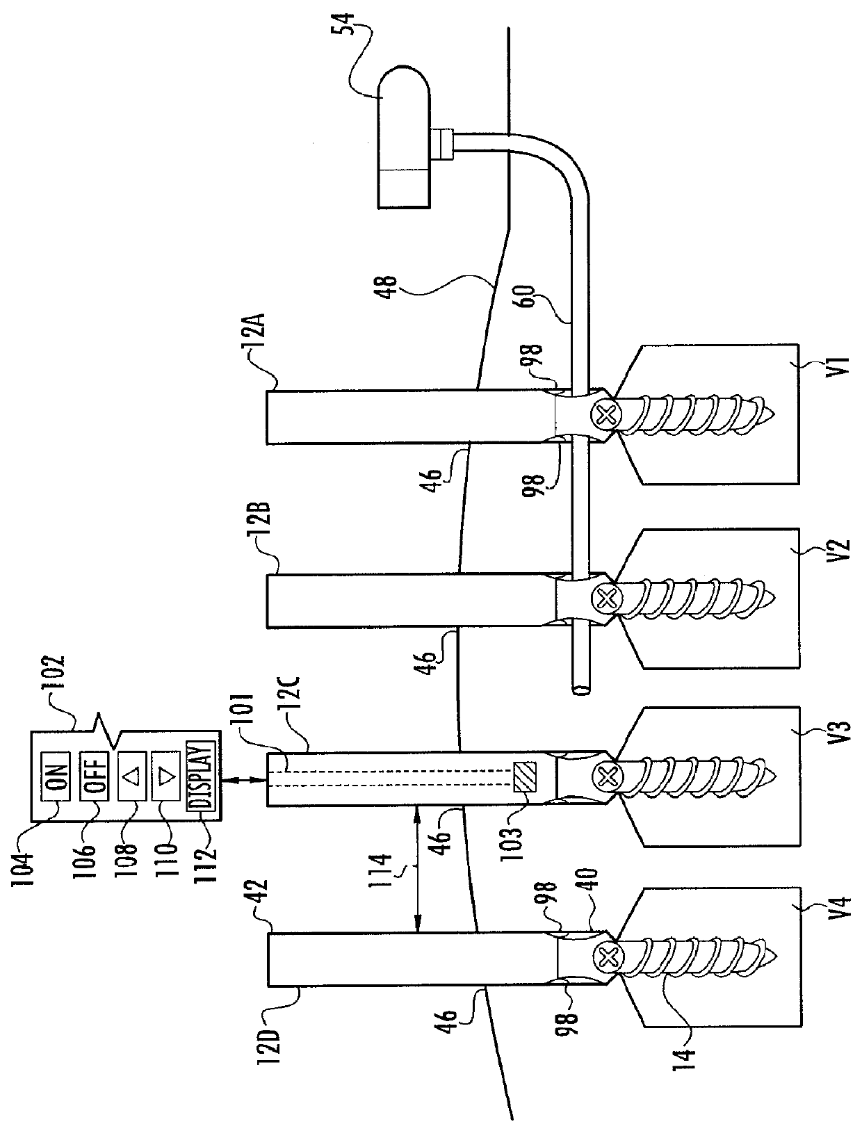 System for Pushing and Pulling Surgical Implants into Position in Vivo Via a Tether