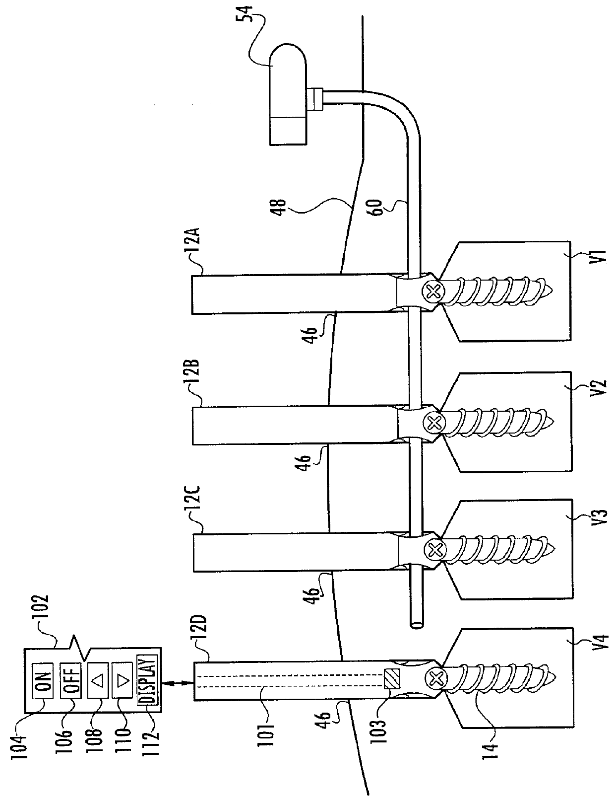 System for Pushing and Pulling Surgical Implants into Position in Vivo Via a Tether