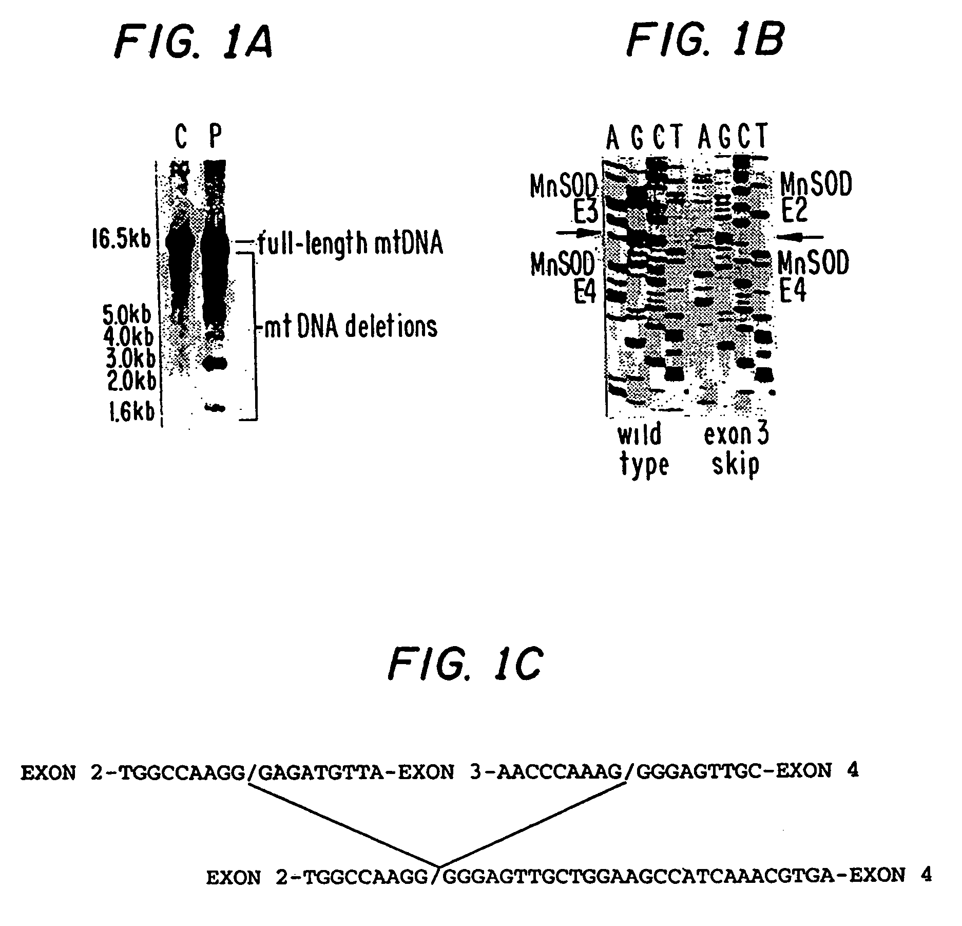 Manganese superoxide dimutase exon 3-deleted isoforms and nucleic acid molecules encoding the isoforms