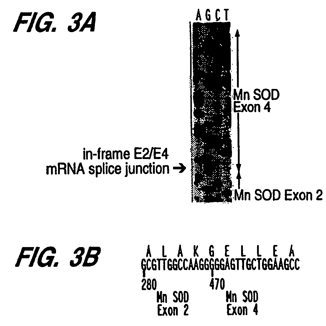 Manganese superoxide dimutase exon 3-deleted isoforms and nucleic acid molecules encoding the isoforms