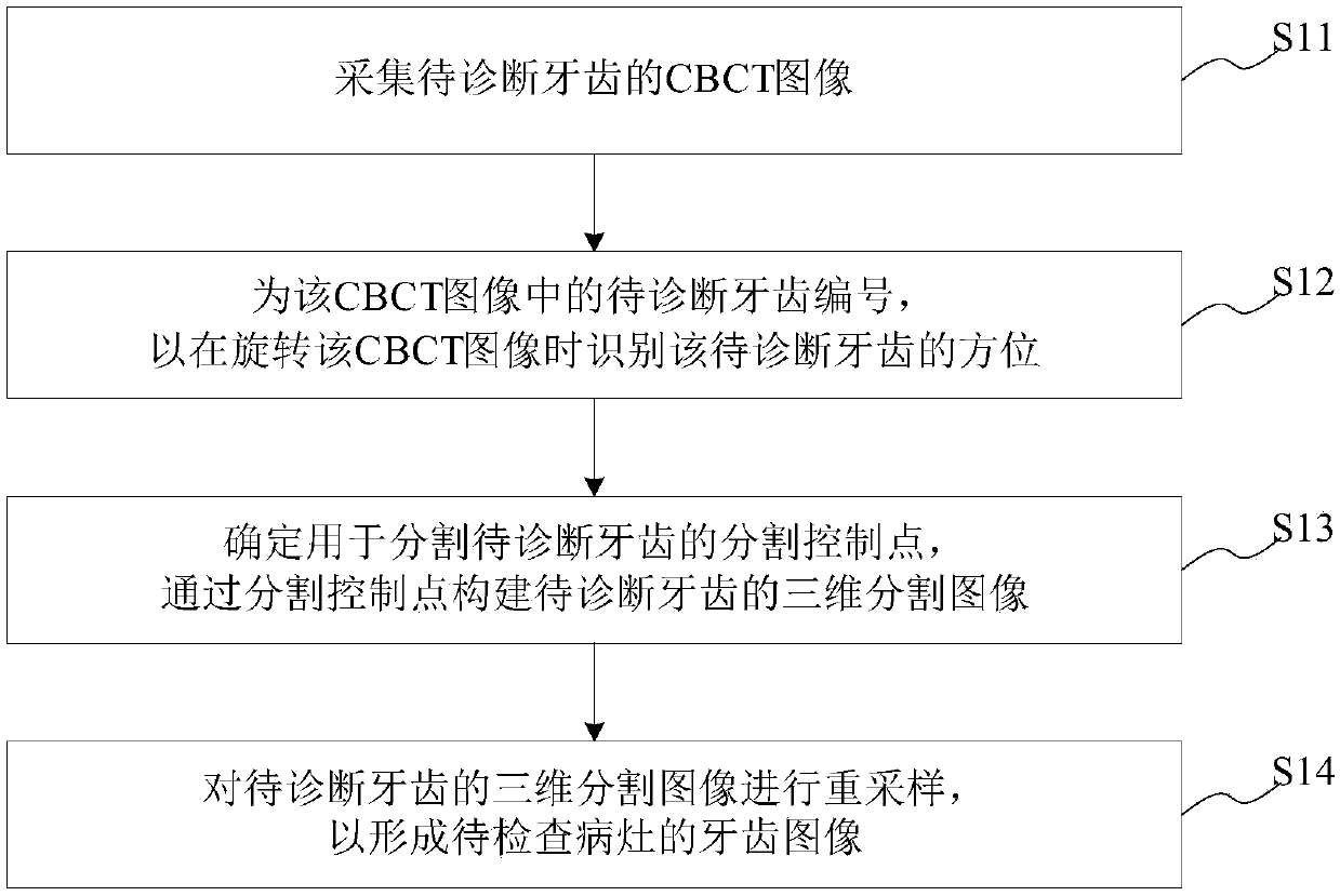 Tooth image processing method and system, computer readable storage medium and equipment