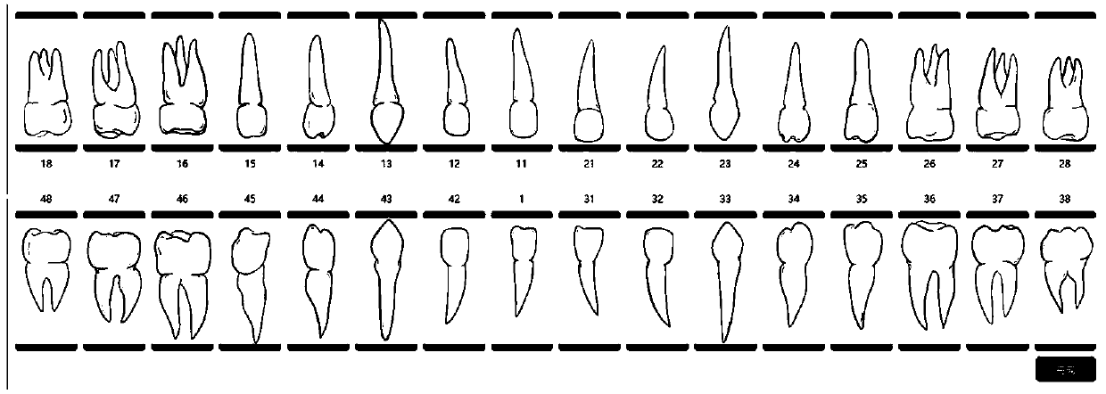 Tooth image processing method and system, computer readable storage medium and equipment