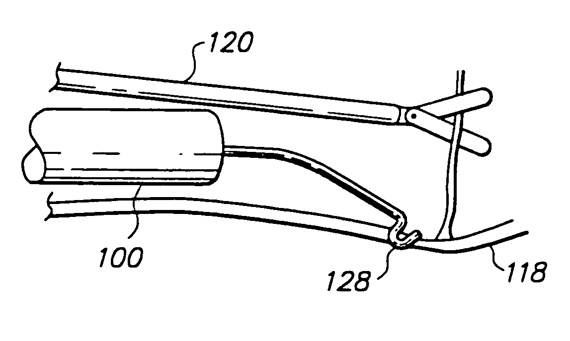 Device and method for remote vessel ligation