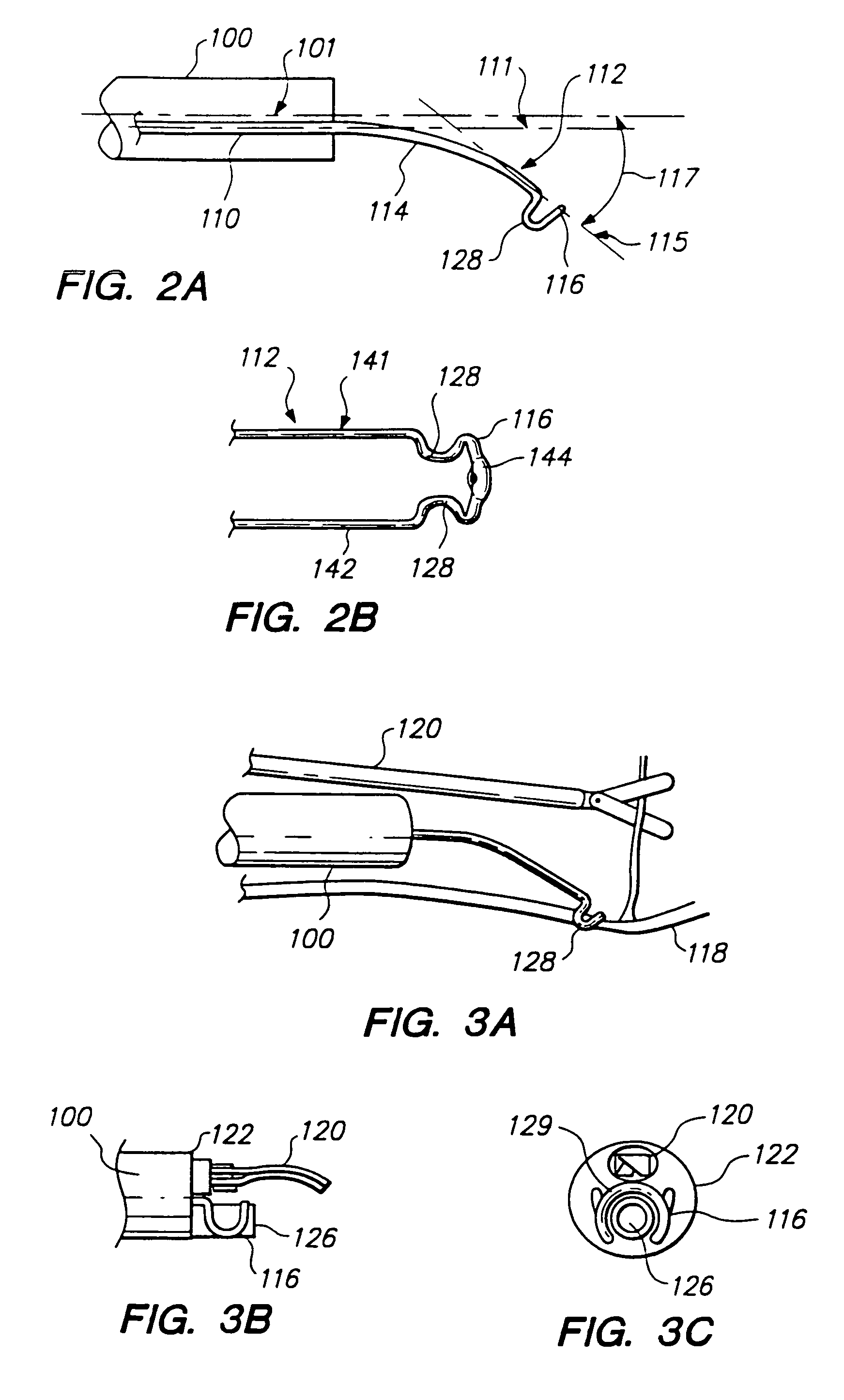 Device and method for remote vessel ligation