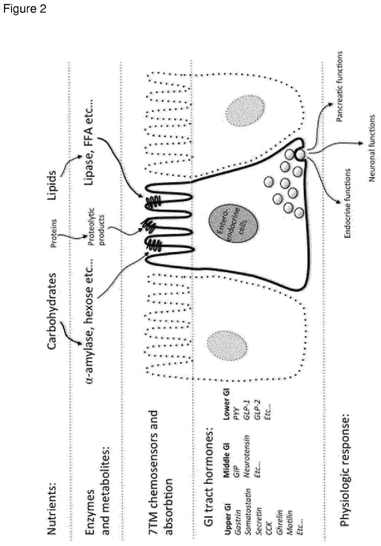 Modified release composition of orlistat and acarbose for the treatment of obesity and related metabolic disorders