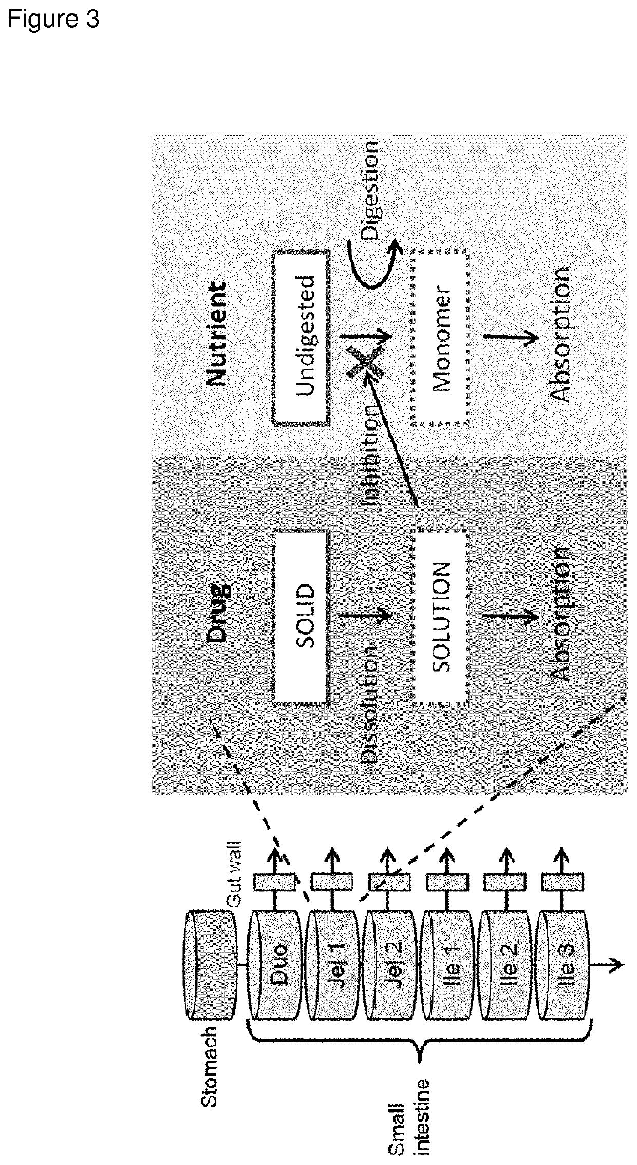 Modified release composition of orlistat and acarbose for the treatment of obesity and related metabolic disorders