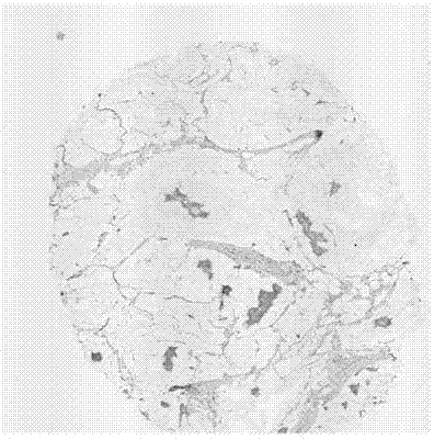 Application of TCP1 protein in preparation of postoperative breast cancer prognosis evaluation kit, postoperative breast cancer prognosis evaluation kit and method