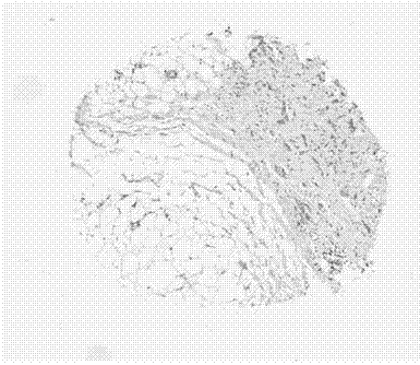 Application of TCP1 protein in preparation of postoperative breast cancer prognosis evaluation kit, postoperative breast cancer prognosis evaluation kit and method