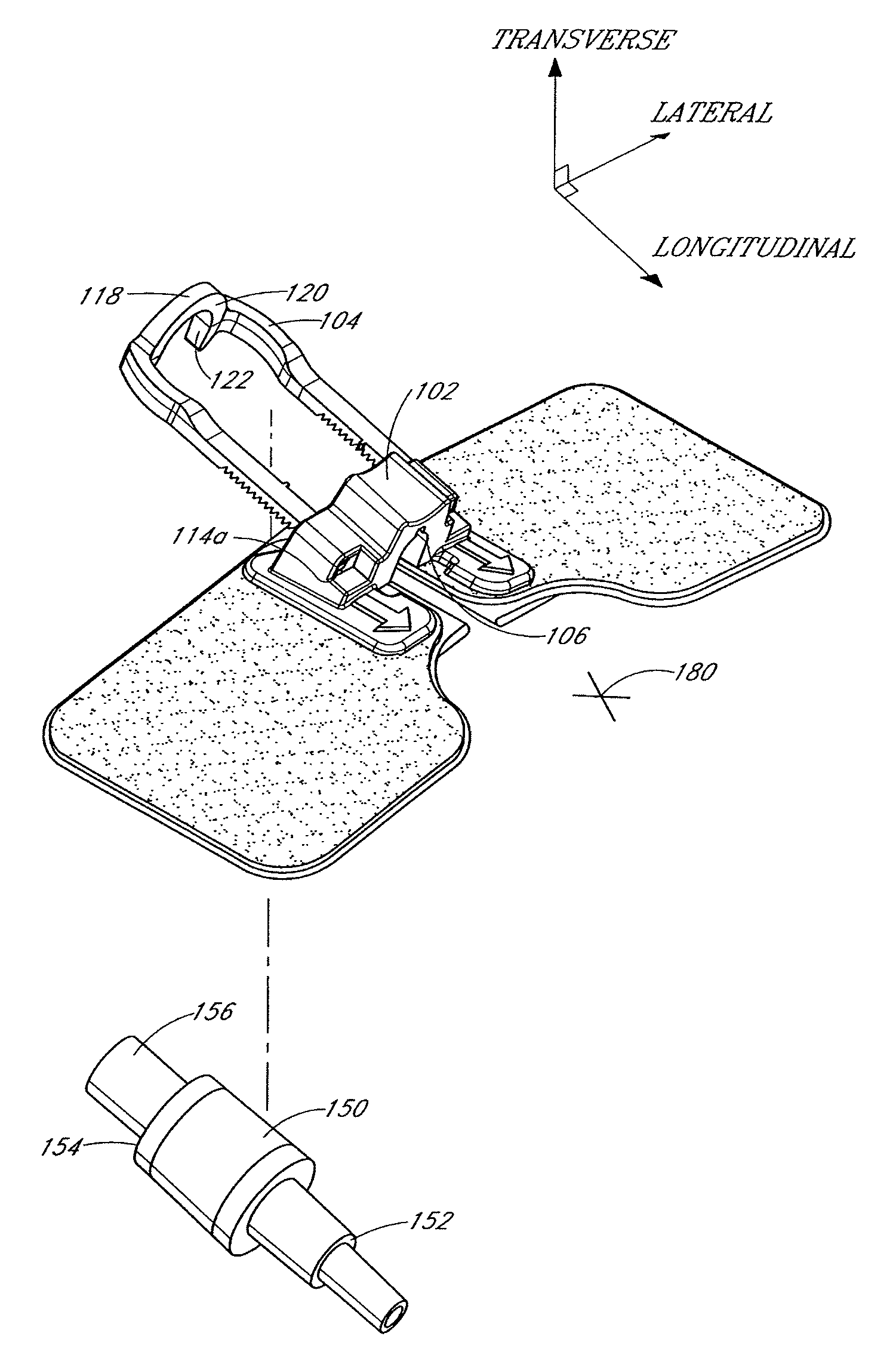 Medical device securement system