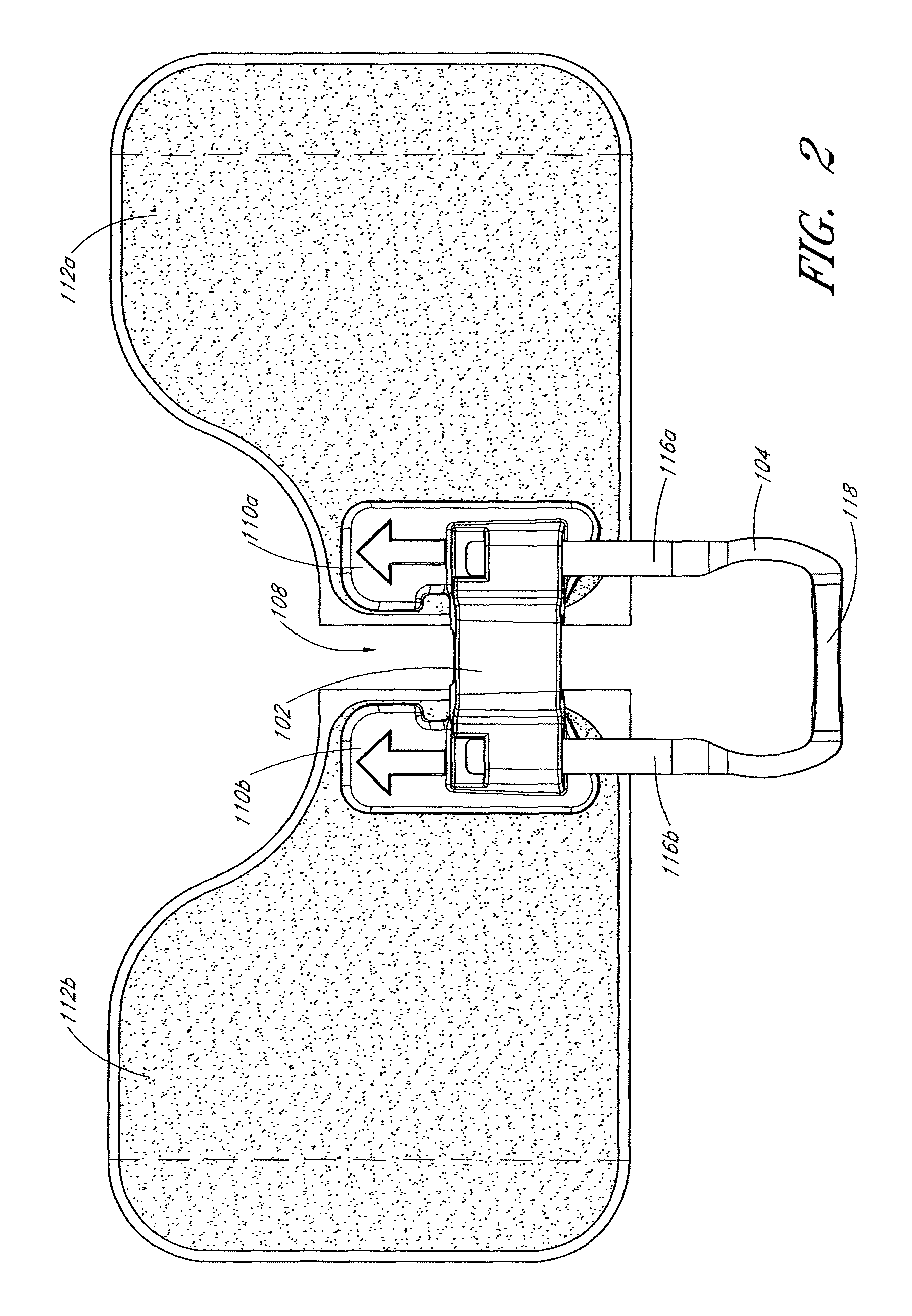 Medical device securement system