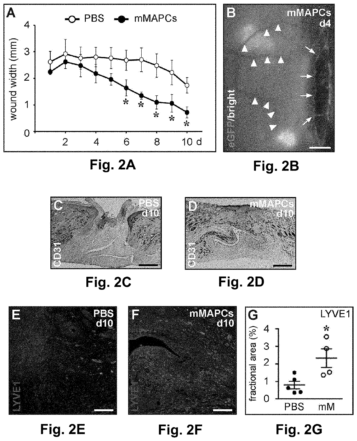 Stem cells for wound healing