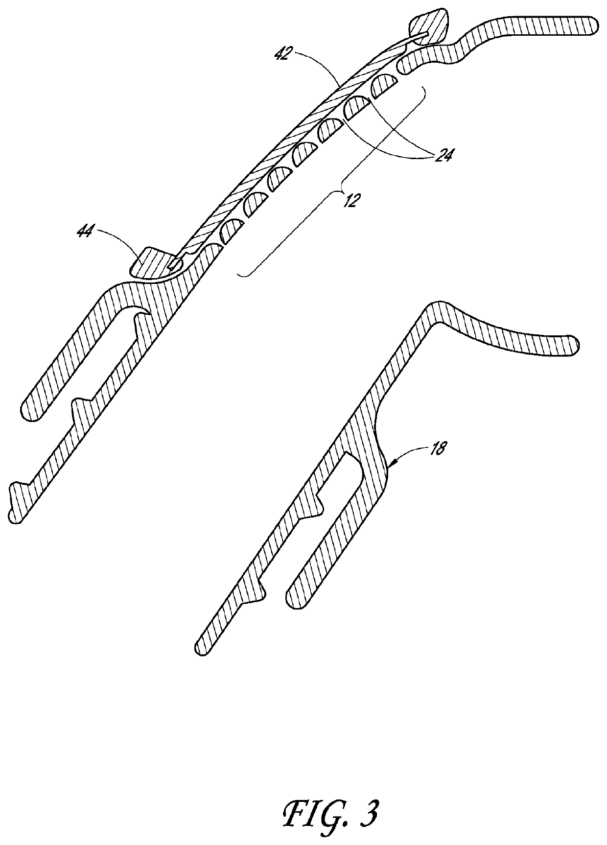 Diffuser arrangements for a vent of a respiratory interface