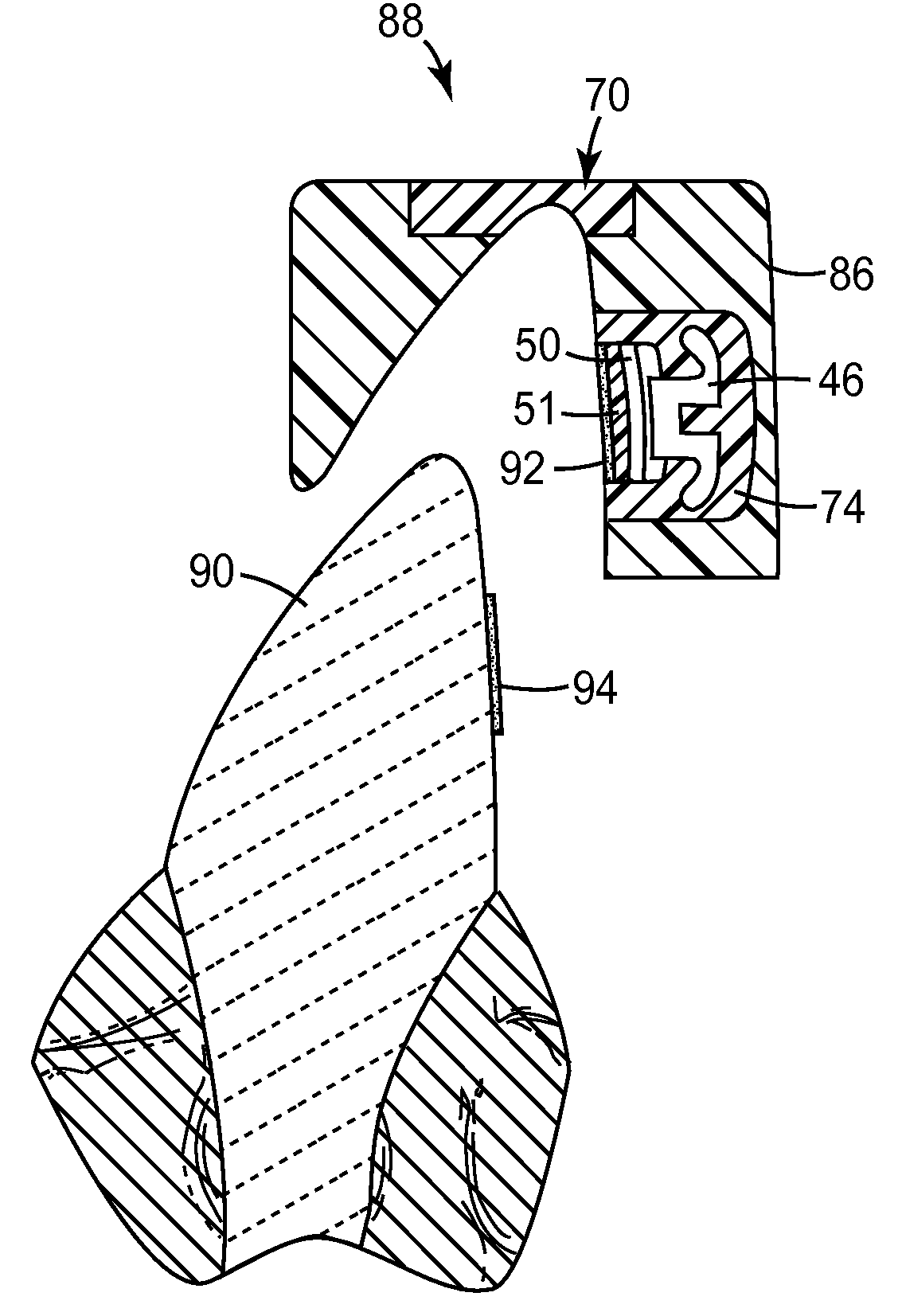 Indirect bonding trays for orthodontic treatment and methods for making the same