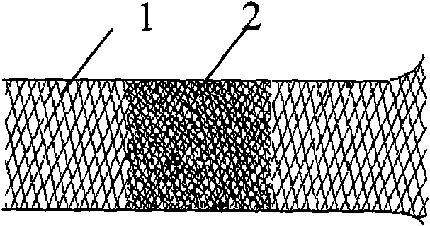 Cerebral aneurysm endovascular plastic repair bracket and conveying device thereof