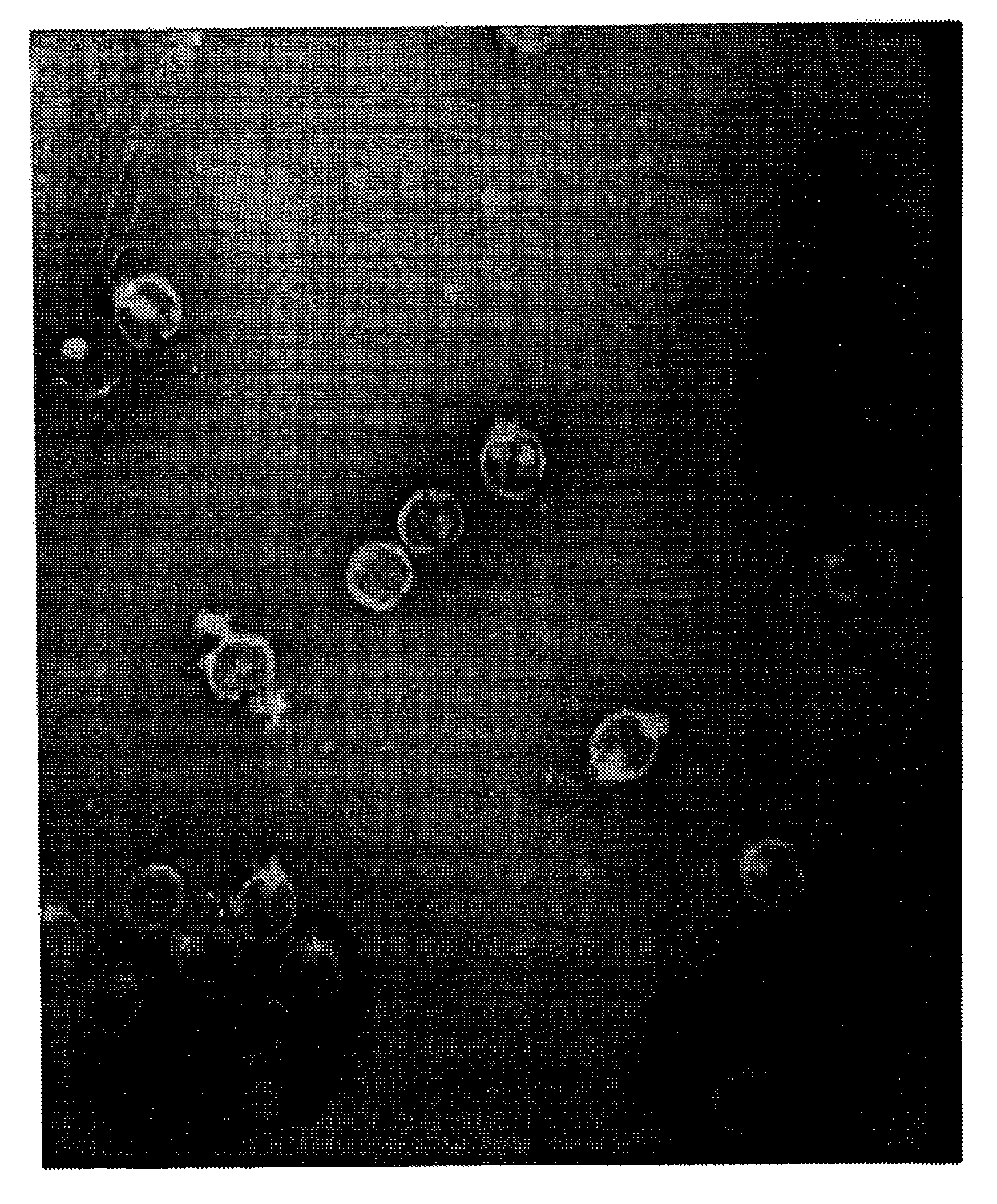 Compositions containing bacteriophages and method of using bacteriophages to treat infections