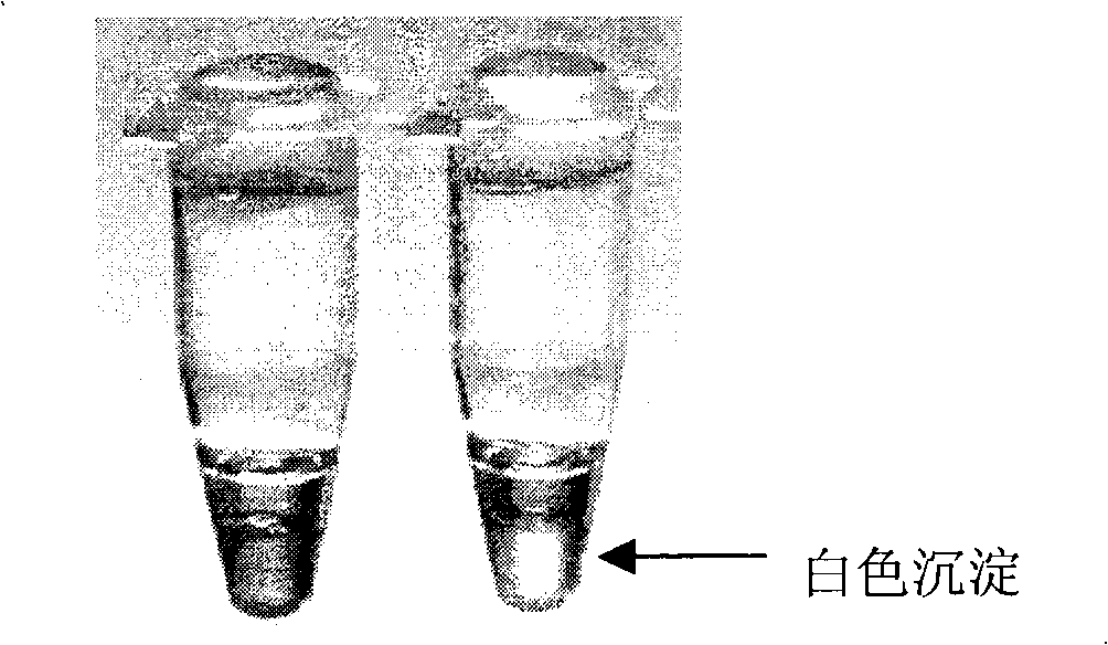 Reagent kit and method for detection of artificial tuberculosis yersinia genus with ring mediated isothermality amplification method