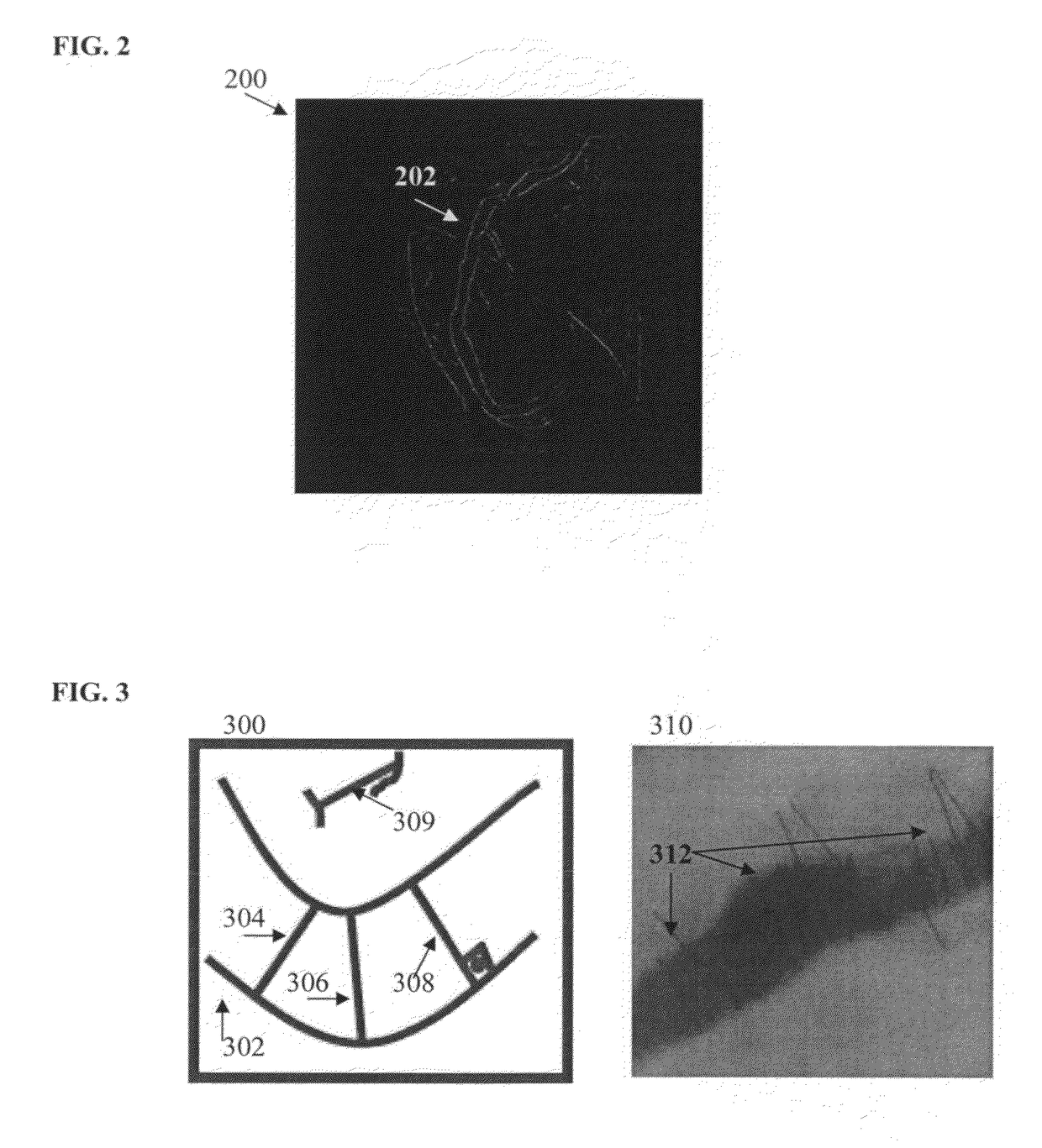 Method and system for vessel segmentation in fluoroscopic images