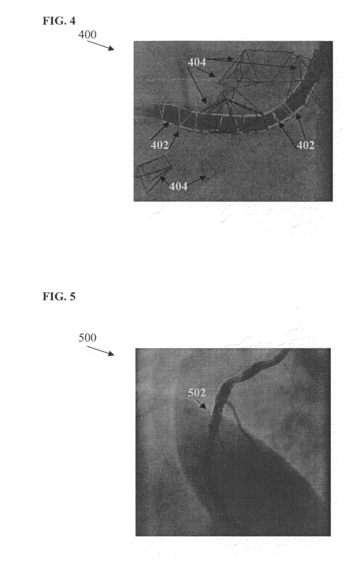 Method and system for vessel segmentation in fluoroscopic images