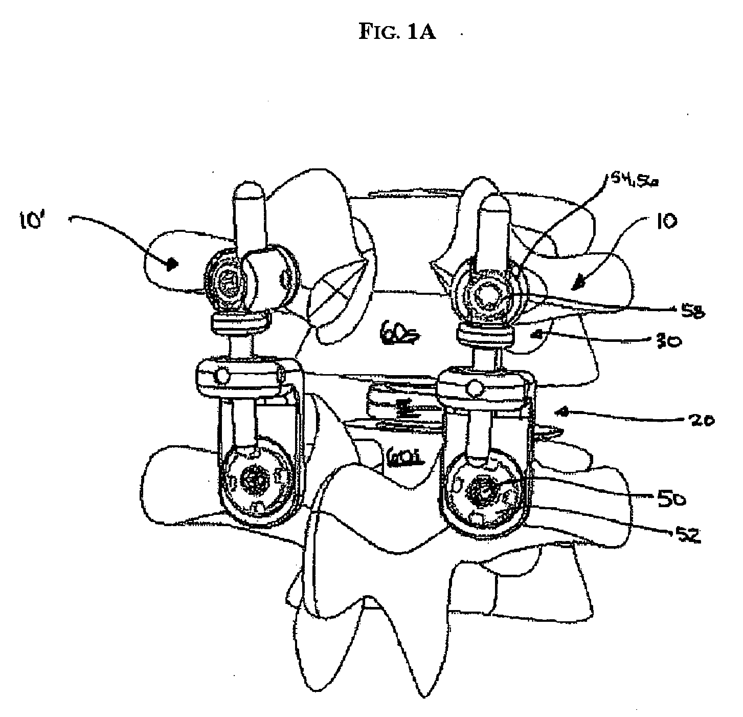 Artificial facet joint