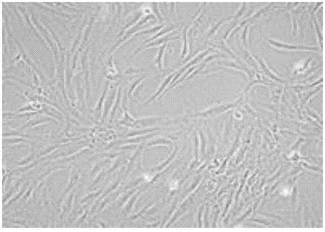 Endometrial stem cell preparation and application thereof