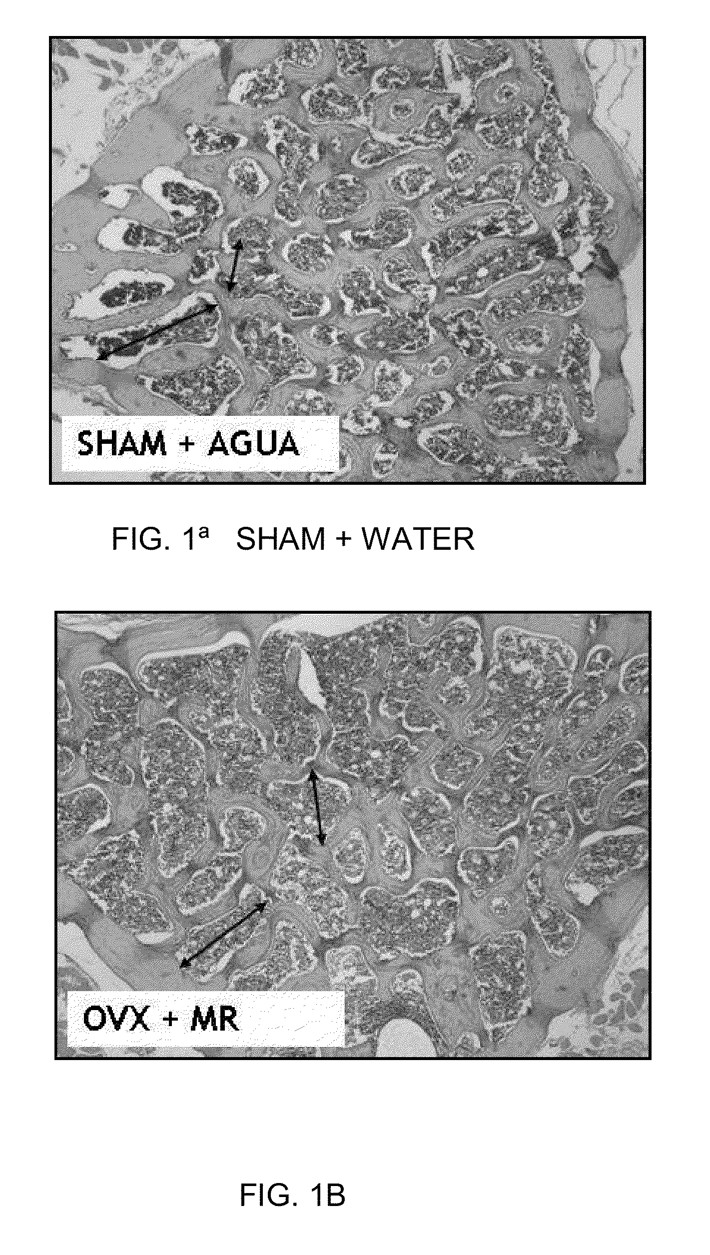 Compositions of atomized or lyophilized maca (<i>Lepidium meyenii</i>) extracts and atomized or lyophilized yacon (<i>Smallanthus sanchifolius</i>) extracts as adjuvants in the treatment of different conditions