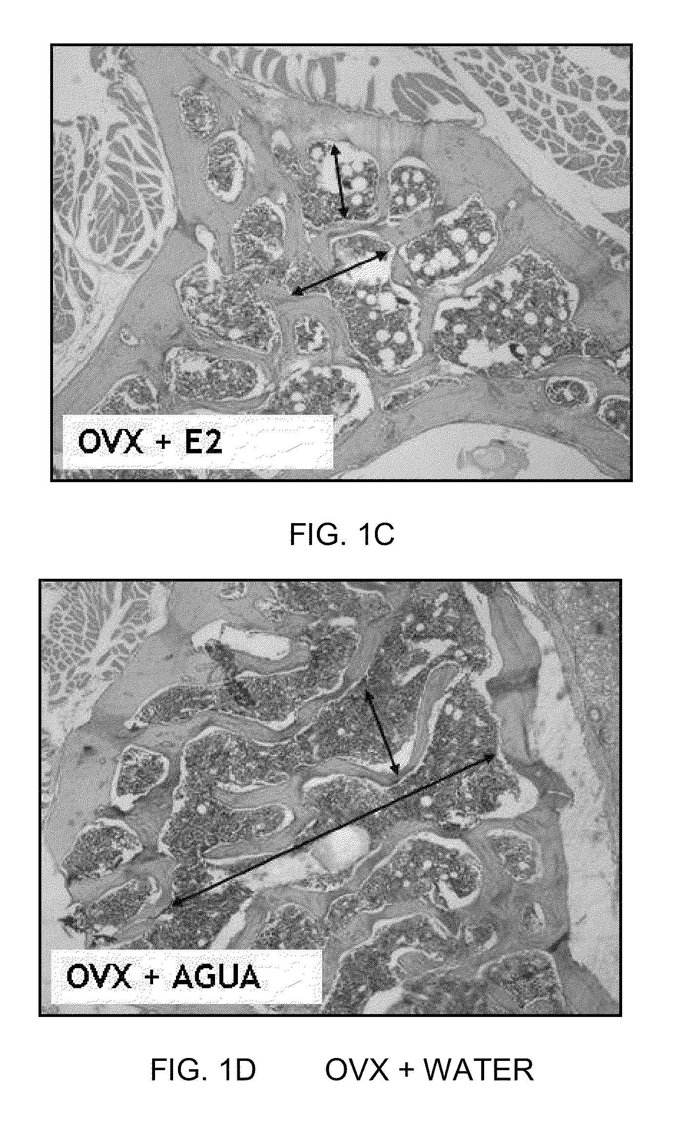 Compositions of atomized or lyophilized maca (<i>Lepidium meyenii</i>) extracts and atomized or lyophilized yacon (<i>Smallanthus sanchifolius</i>) extracts as adjuvants in the treatment of different conditions