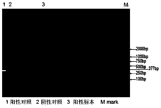 Specific trichomonas vaginalis nested PCR (Polymerase Chain Reaction) detection kit