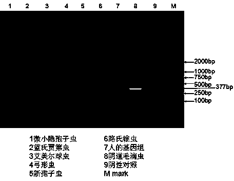 Specific trichomonas vaginalis nested PCR (Polymerase Chain Reaction) detection kit