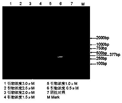 Specific trichomonas vaginalis nested PCR (Polymerase Chain Reaction) detection kit