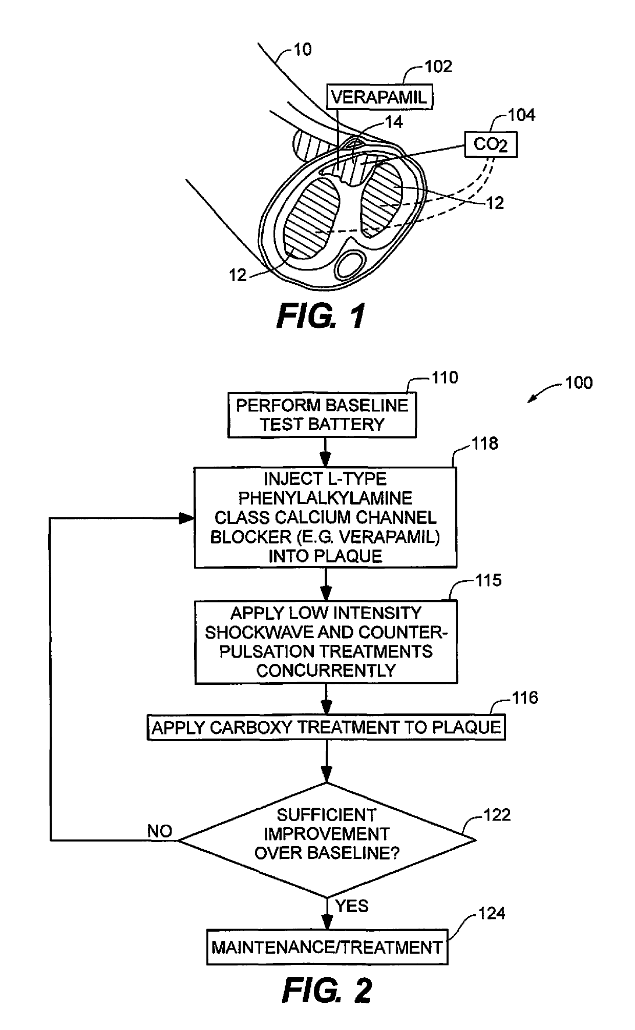 Method for treating Peyronie's disease