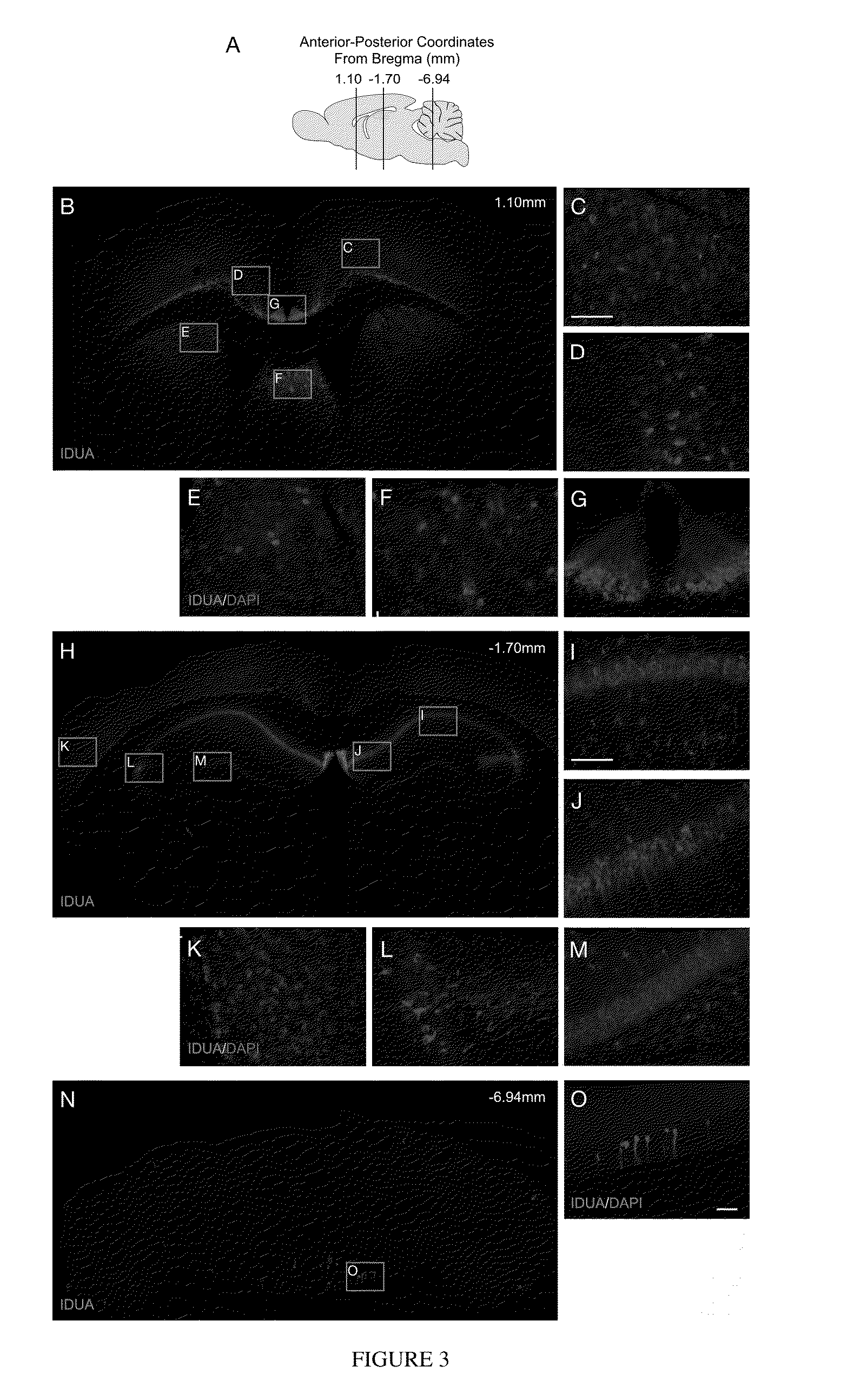 Intranasal delivery of therapeutic enzymes to the central nervous system for the treatment of lysosomal storage diseases