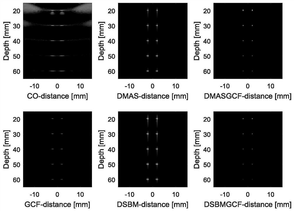 An Ultrasonic Plane Wave Imaging Method Based on Improved DMAS Algorithm