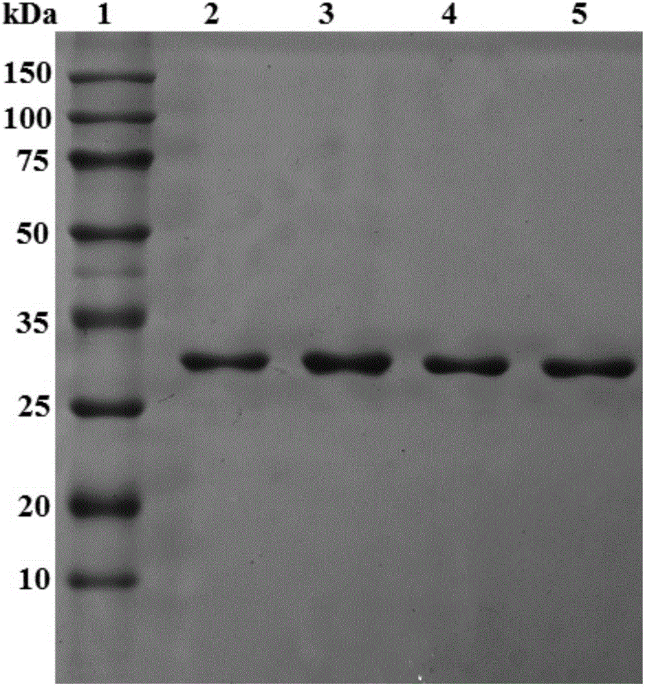 Mutant short-chain dehydrogenase, recombinant expression vector, genetic engineering bacterium and application