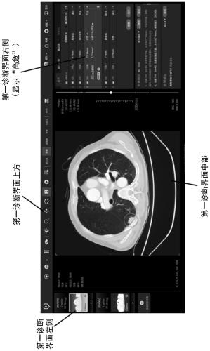 Medical image display method, information processing method and storage medium