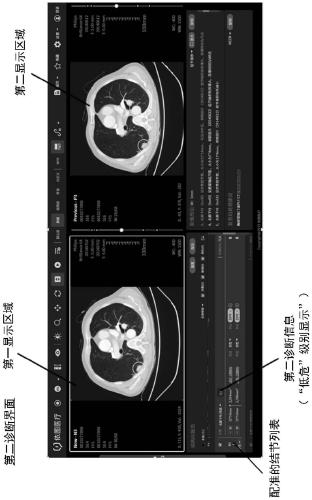 Medical image display method, information processing method and storage medium