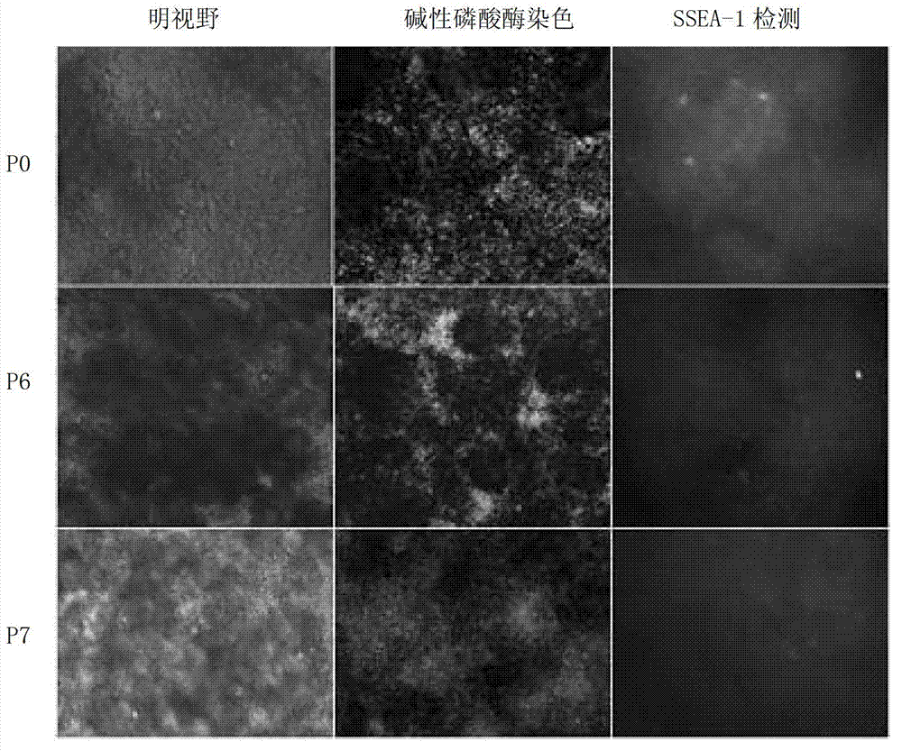 Embryonic stem cell culture medium and application thereof