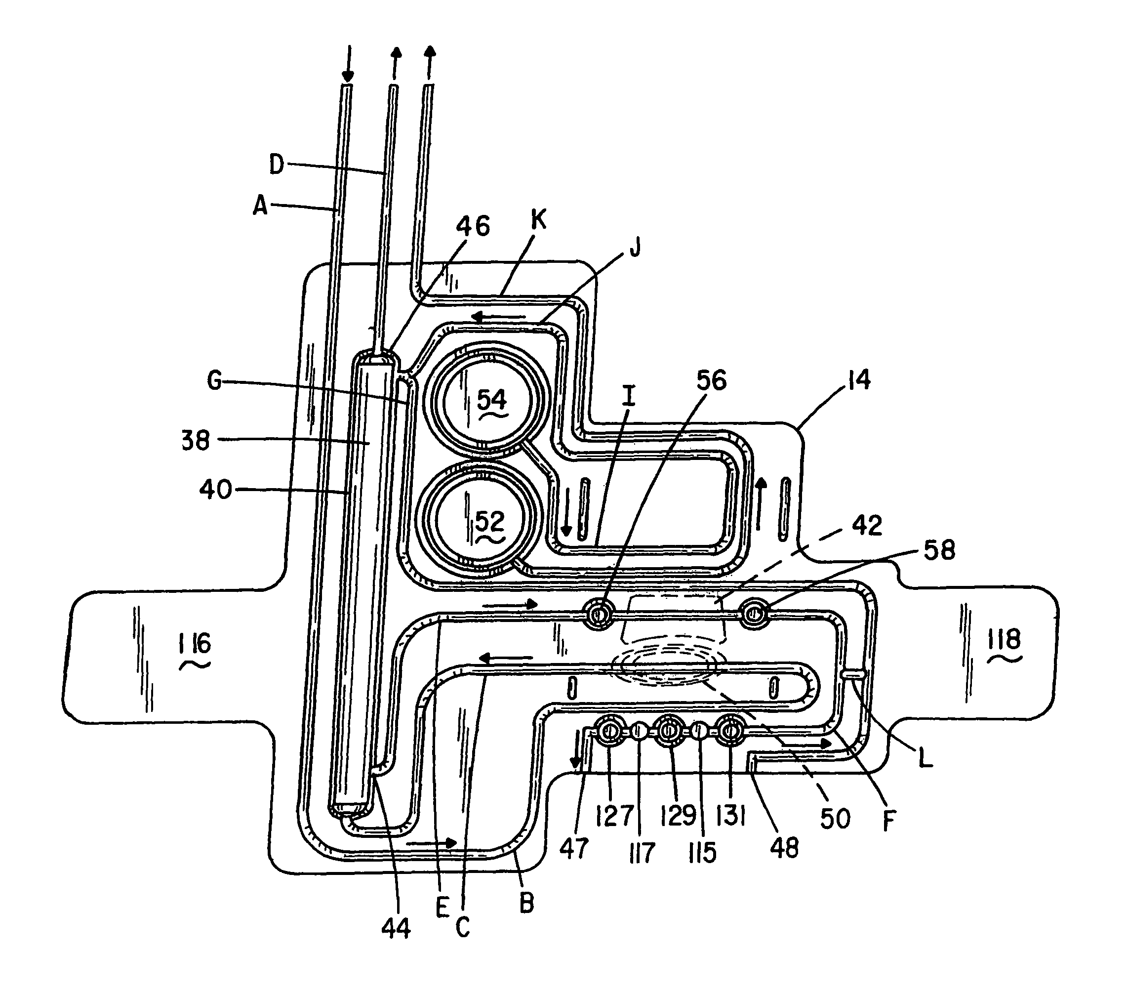 Chronic access system for extracorporeal treatment of blood including a continously wearable hemodialyzer