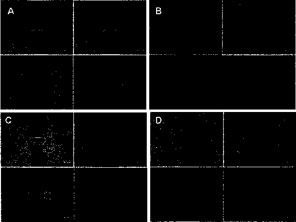 Preparation method and application of anthraquinone polypyridine ligand and binuclear ruthenium complexes