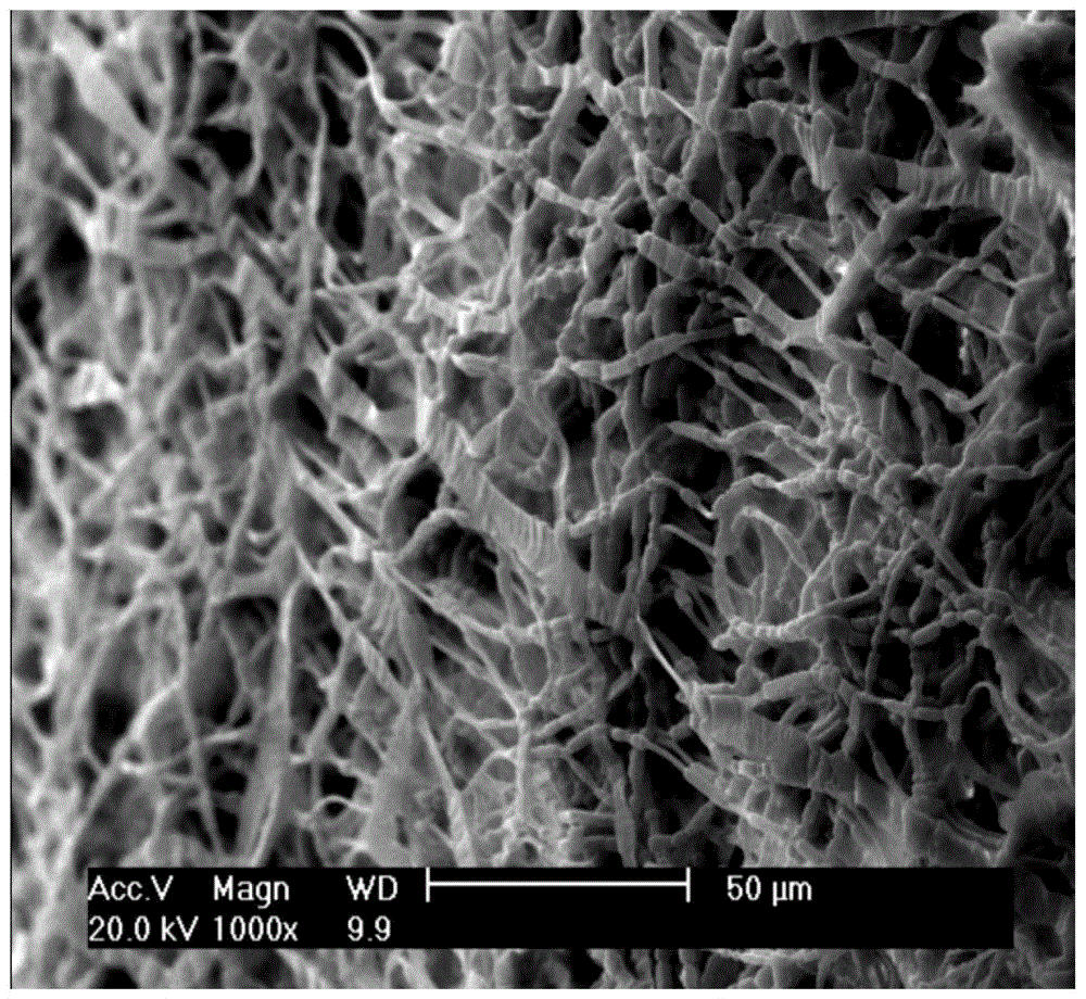 Implanted fibrous membrane for repairing pelvic floor dysfunctional disease, preparation method and medical device containing same